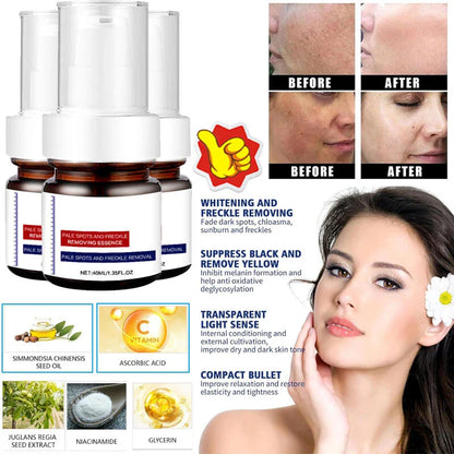 ⚡5-second brightening rescue: Dark spots disappear, blemishes fade, and skin becomes radiant! Vitamin C Whitening Freckles ESSENCE(3 HOURS LEFT!)